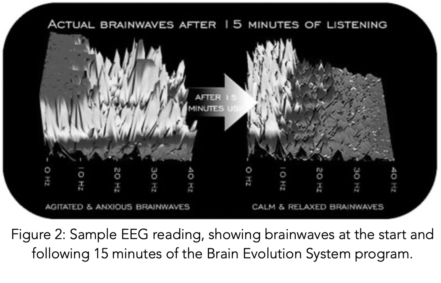 Screen display of EEG during a Guided Meditation